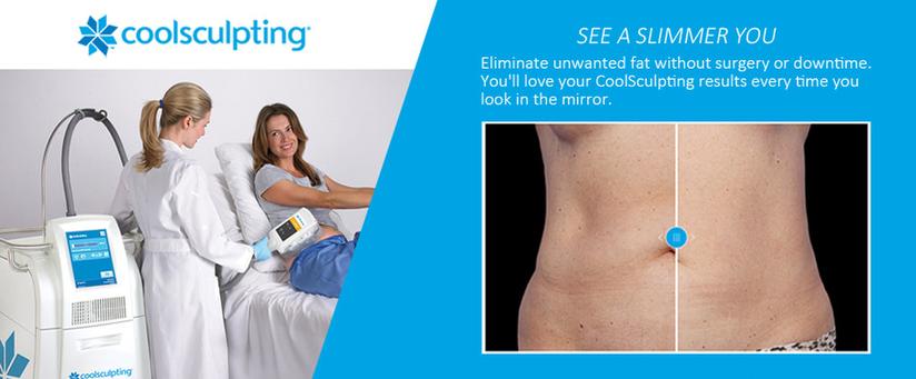 Coolsculpting